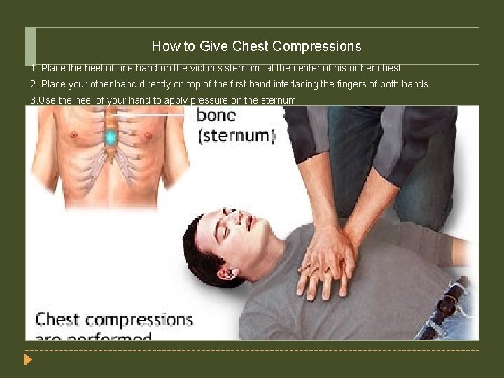 How to Give Chest Compressions 1. Place the heel of one hand on the