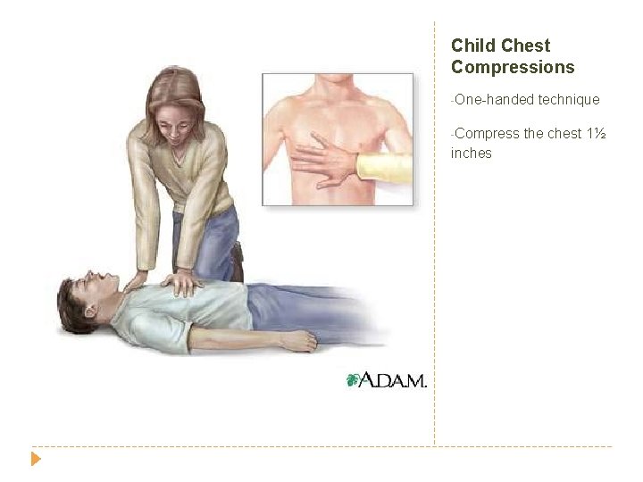 Child Chest Compressions -One-handed -Compress inches technique the chest 1½ 