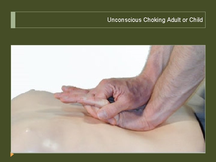 Unconscious Choking Adult or Child 