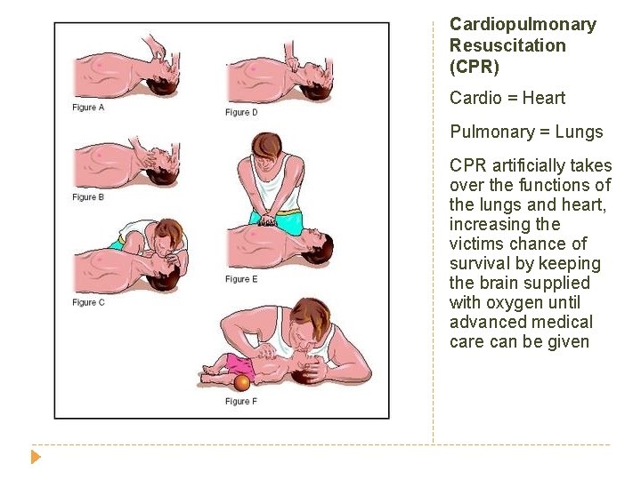 Cardiopulmonary Resuscitation (CPR) Cardio = Heart Pulmonary = Lungs CPR artificially takes over the