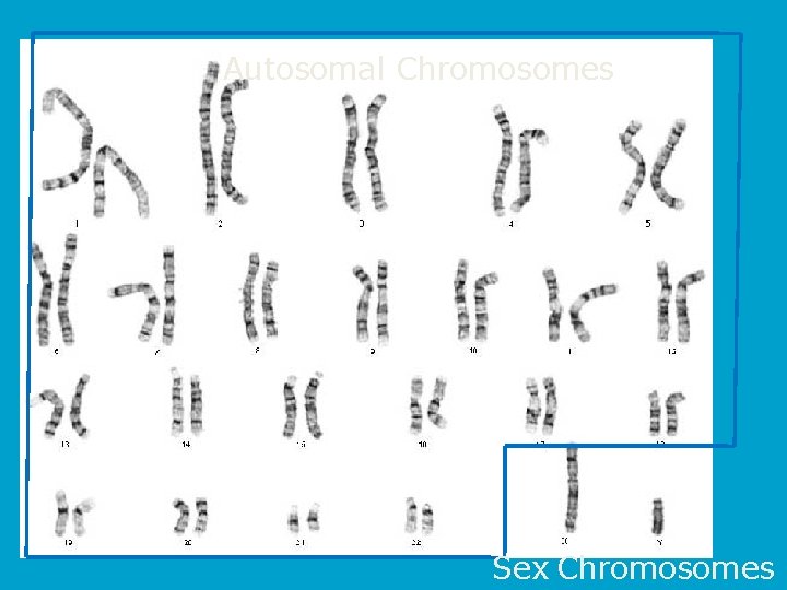 Autosomal Chromosomes Sex Chromosomes 