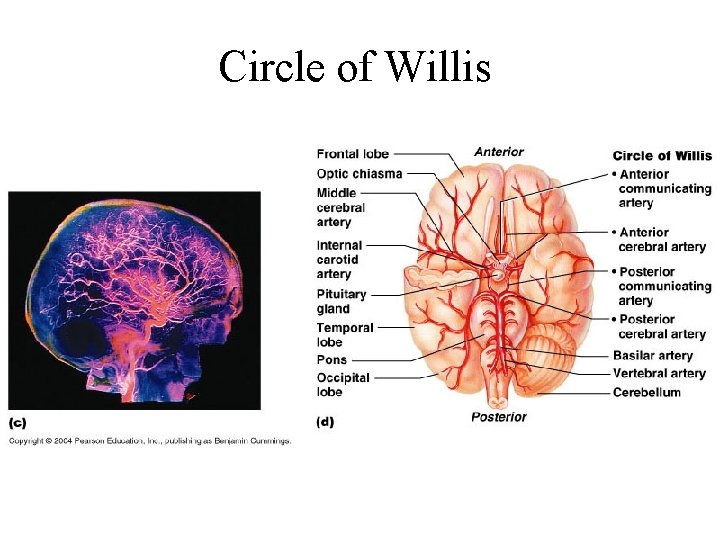 Circle of Willis 