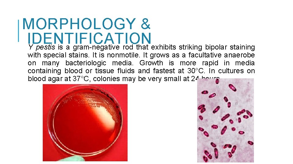 MORPHOLOGY & IDENTIFICATION Y pestis is a gram-negative rod that exhibits striking bipolar staining