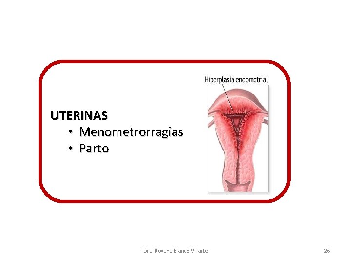 UTERINAS • Menometrorragias • Parto Dra. Roxana Blanco Villarte 26 