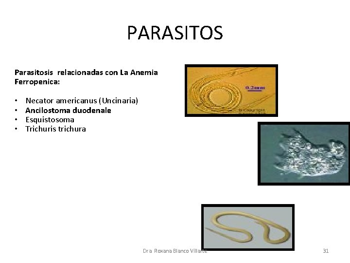 PARASITOS Parasitosis relacionadas con La Anemia Ferropenica: • • Necator americanus (Uncinaria) Ancilostoma duodenale
