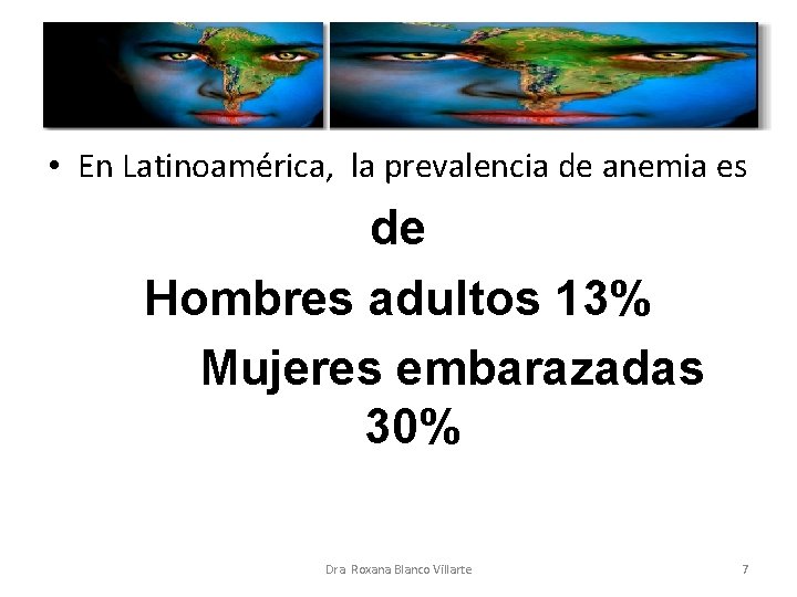  • En Latinoamérica, la prevalencia de anemia es de Hombres adultos 13% Mujeres