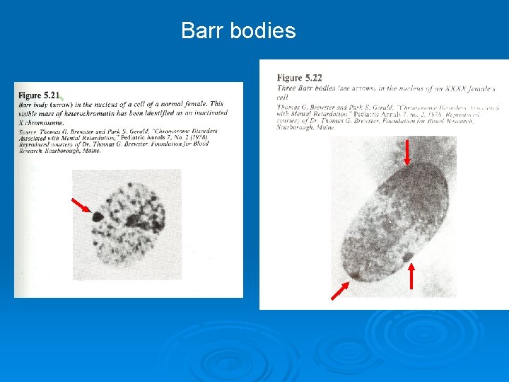 Barr bodies 