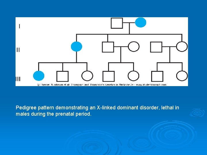 Pedigree pattern demonstrating an X-linked dominant disorder, lethal in males during the prenatal period.