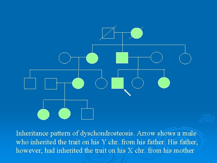 Inheritance pattern of dyschondrosteosis. Arrow shows a male who inherited the trait on his