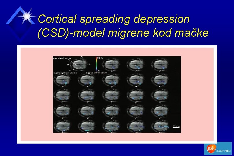 Cortical spreading depression (CSD)-model migrene kod mačke 