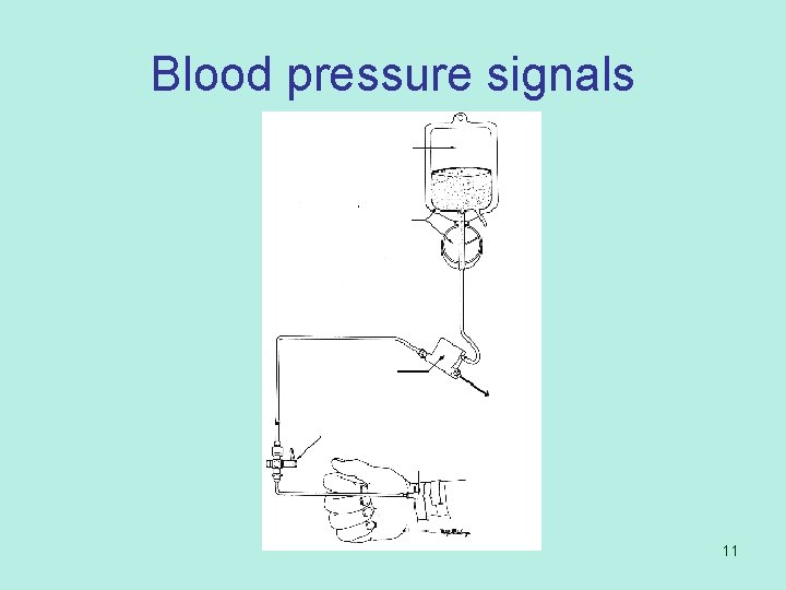 Blood pressure signals 11 