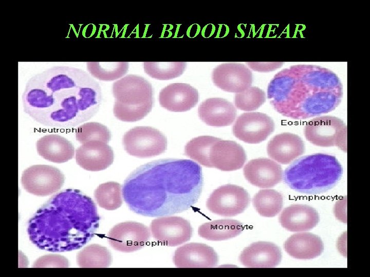 NORMAL BLOOD SMEAR 