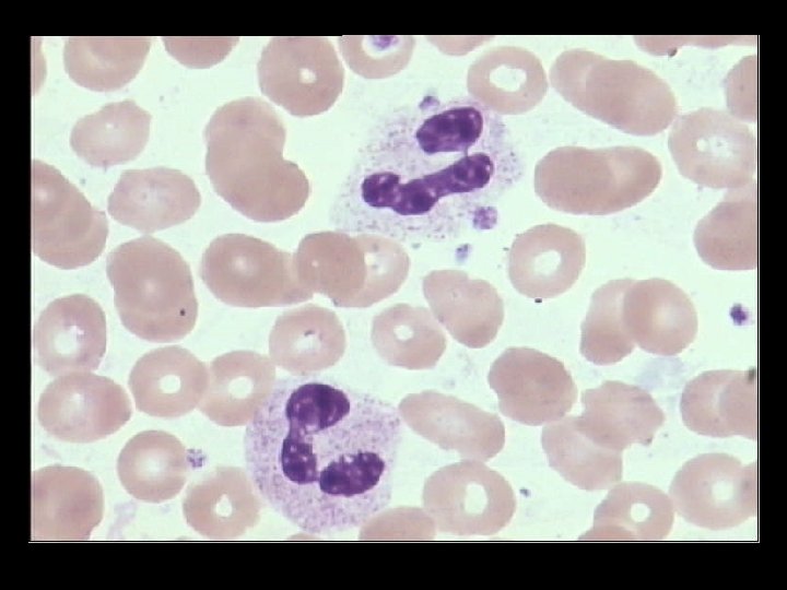 SEGMENTED NEUTROPHIL 
