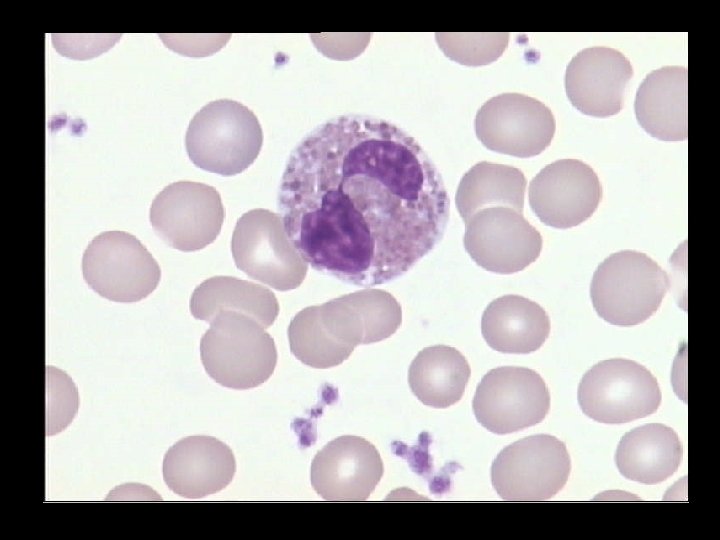 EOSINOPHIL 