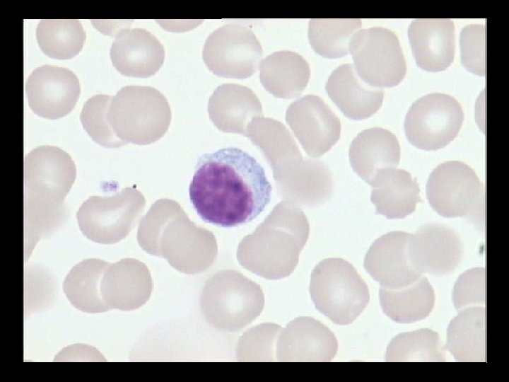 LYMPHOCYTE 