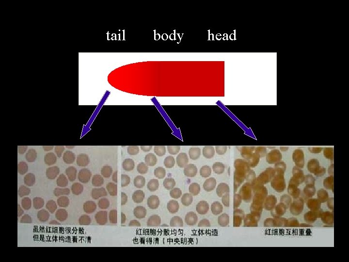tail body head 