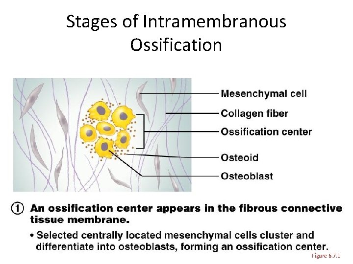 Stages of Intramembranous Ossification Figure 6. 7. 1 Stages of Intramembranous Ossification Figure 6. 7. 1