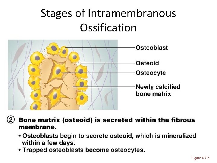 Stages of Intramembranous Ossification Figure 6. 7. 2 Stages of Intramembranous Ossification Figure 6. 7. 2