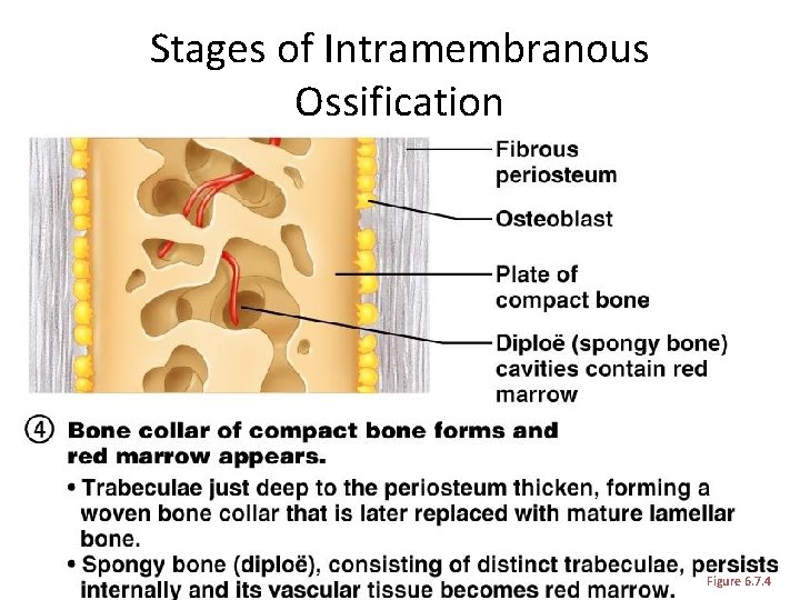 Stages of Intramembranous Ossification Figure 6. 7. 4 Stages of Intramembranous Ossification Figure 6. 7. 4