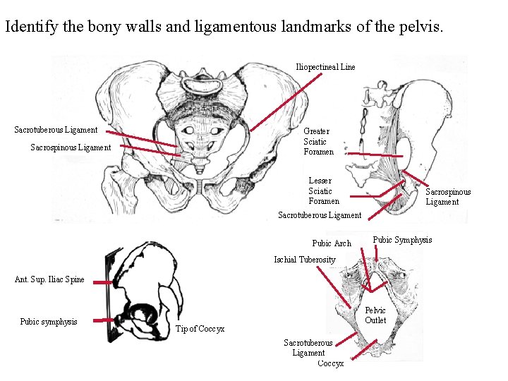 Identify the bony walls and ligamentous landmarks of the pelvis. Iliopectineal Line Sacrotuberous Ligament