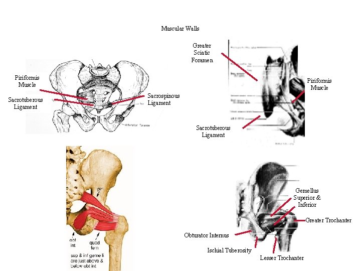 Muscular Walls Greater Sciatic Foramen Piriformis Muscle Sacrotuberous Ligament Piriformis Muscle Sacrospinous Ligament Sacrotuberous