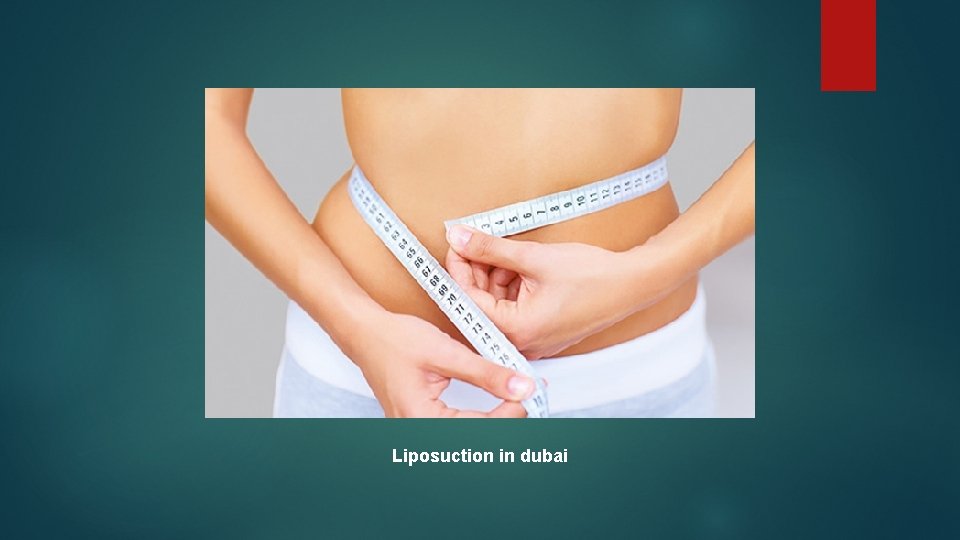 Liposuction in dubai 