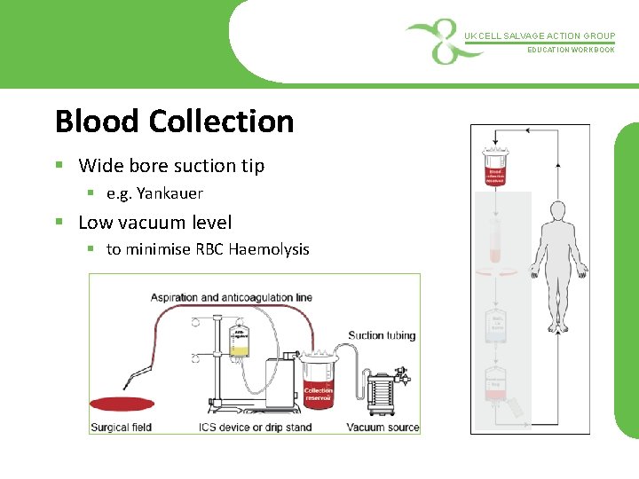 UK CELL SALVAGE ACTION GROUP EDUCATION WORKBOOK Blood Collection § Wide bore suction tip