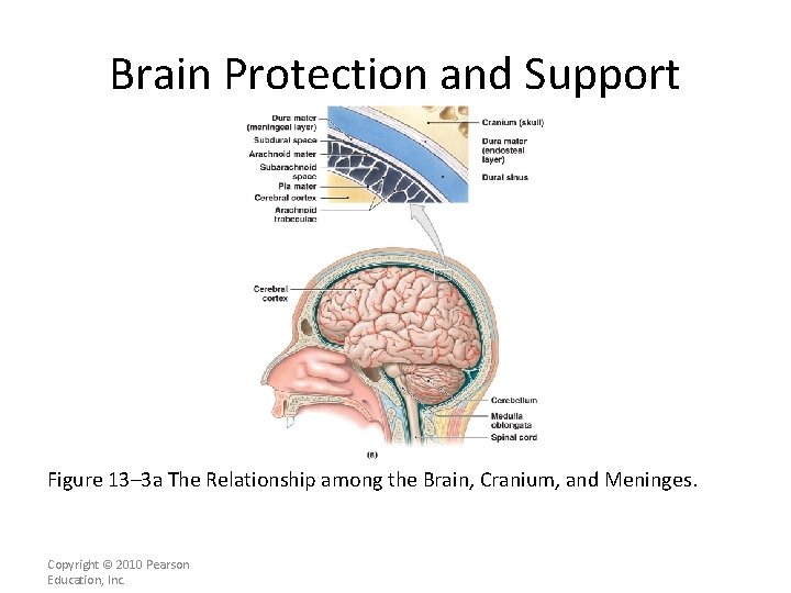 Brain Protection and Support Figure 13– 3 a The Relationship among the Brain, Cranium,