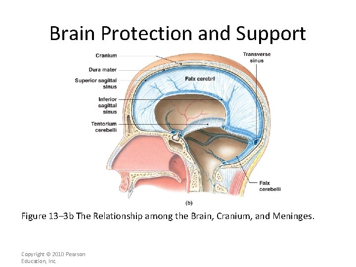 Brain Protection and Support Figure 13– 3 b The Relationship among the Brain, Cranium,