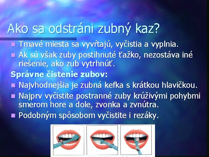 Ako sa odstráni zubný kaz? Tmavé miesta sa vyvŕtajú, vyčistia a vyplnia. n Ak