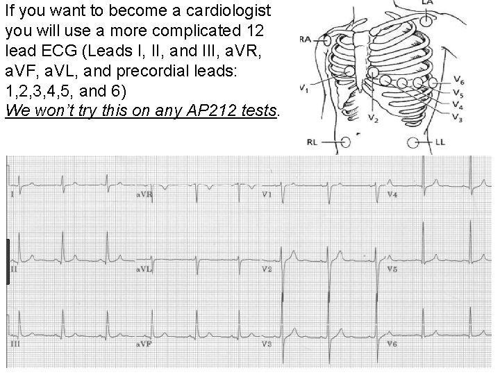 If you want to become a cardiologist you will use a more complicated 12