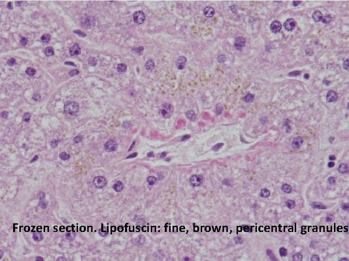 Frozen section. Lipofuscin: fine, brown, pericentral granules 