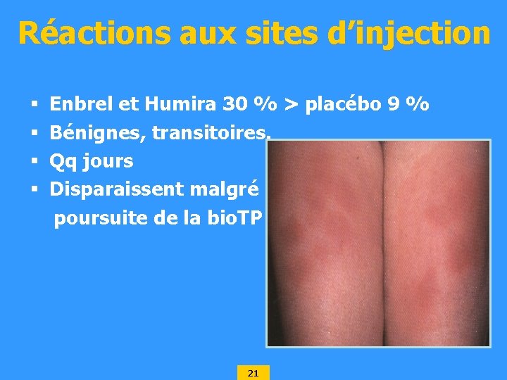 Réactions aux sites d’injection § § Enbrel et Humira 30 % > placébo 9