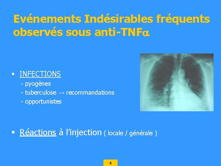 Evénements Indésirables fréquents observés sous anti-TNF § INFECTIONS - pyogènes - tuberculose → recommandations