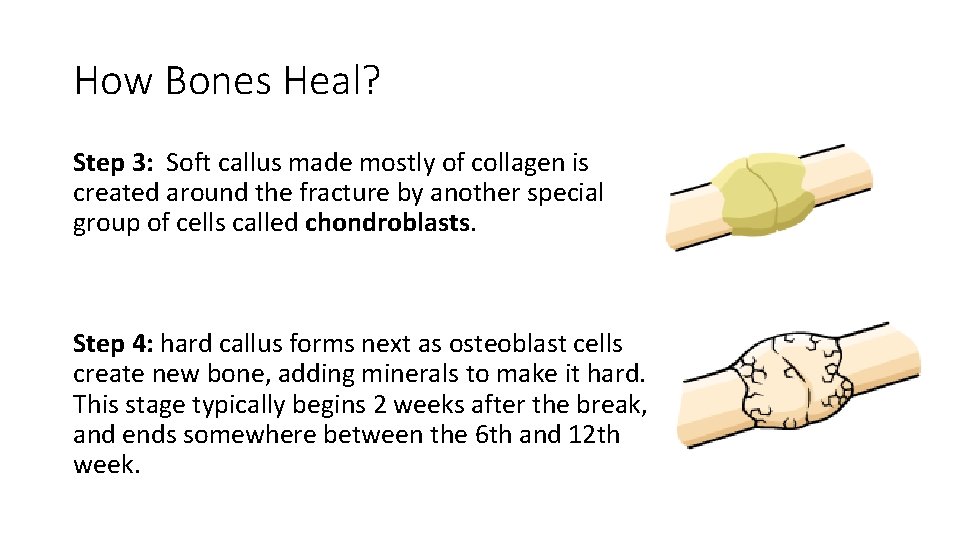 Skeletal System Joints and Diseases Bell Work 1