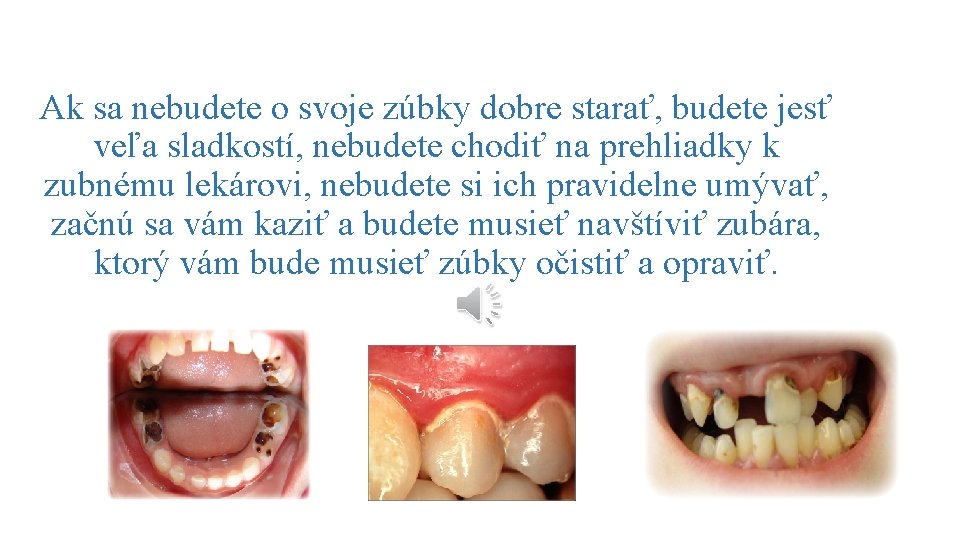 Ak sa nebudete o svoje zúbky dobre starať, budete jesť veľa sladkostí, nebudete chodiť