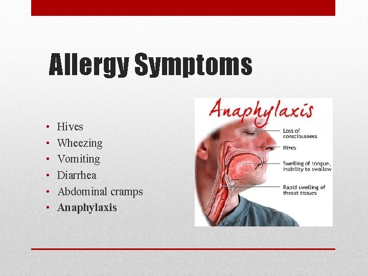 Allergy Symptoms • • • Hives Wheezing Vomiting Diarrhea Abdominal cramps Anaphylaxis 