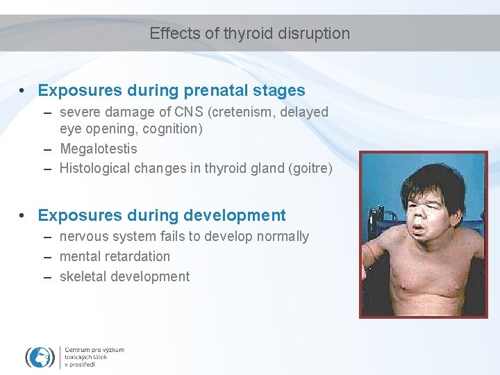 Effects of thyroid disruption • Exposures during prenatal stages – severe damage of CNS