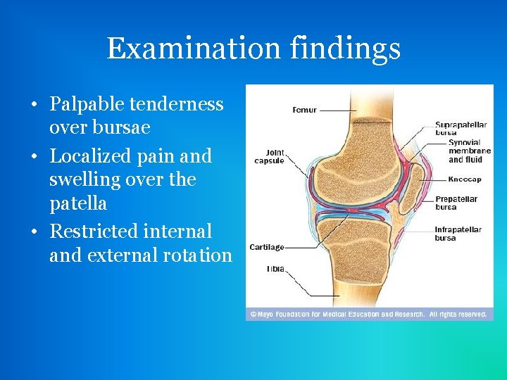 Examination findings • Palpable tenderness over bursae • Localized pain and swelling over the