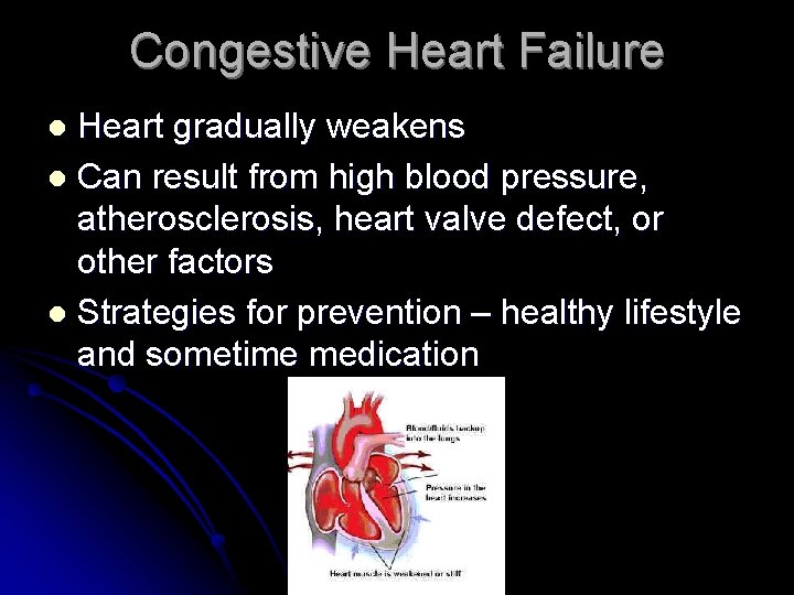 Congestive Heart Failure Heart gradually weakens l Can result from high blood pressure, atherosclerosis,