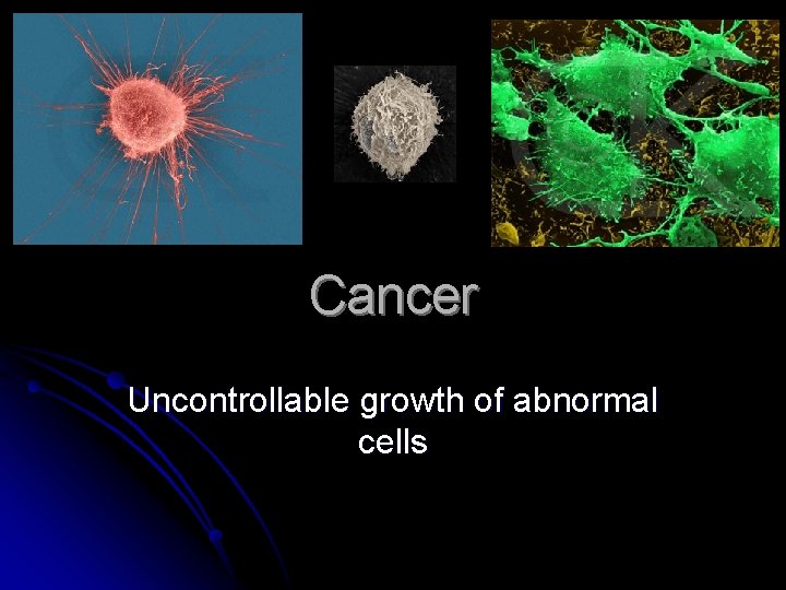 Cancer Uncontrollable growth of abnormal cells 