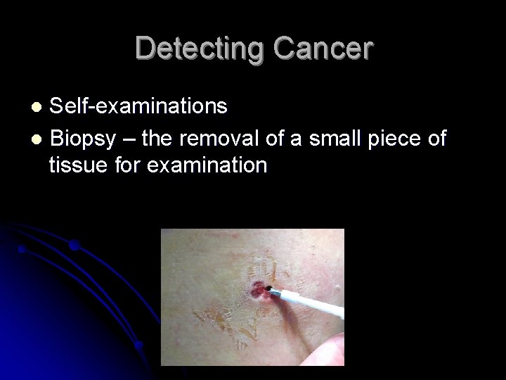 Detecting Cancer Self-examinations l Biopsy – the removal of a small piece of tissue