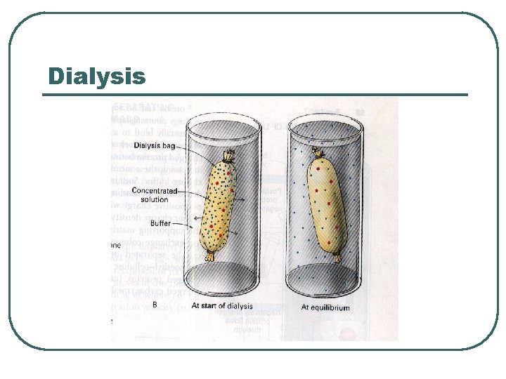 Dialysis 