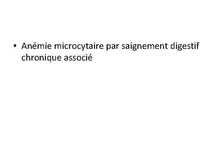  • Anémie microcytaire par saignement digestif chronique associé 