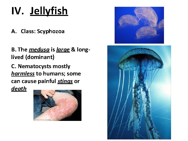 IV. Jellyfish A. Class: Scyphozoa B. The medusa is large & longlived (dominant) C.