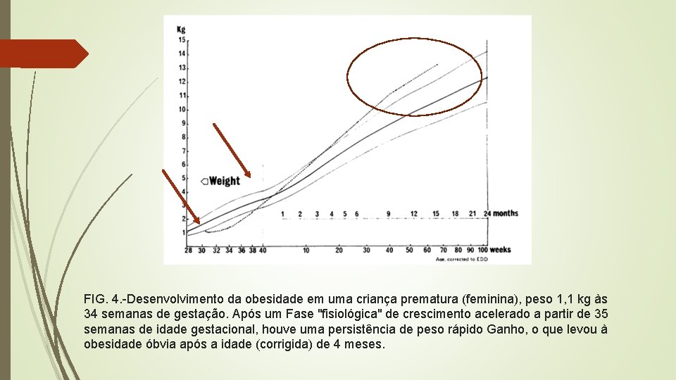 FIG. 4. -Desenvolvimento da obesidade em uma criança prematura (feminina), peso 1, 1 kg