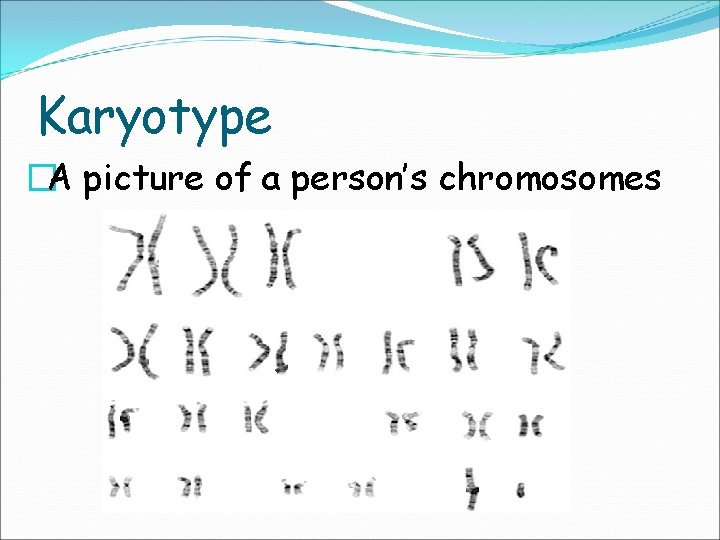 Karyotype �A picture of a person’s chromosomes 