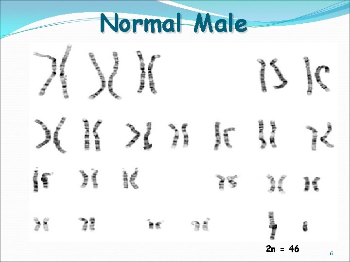 Normal Male 2 n = 46 6 