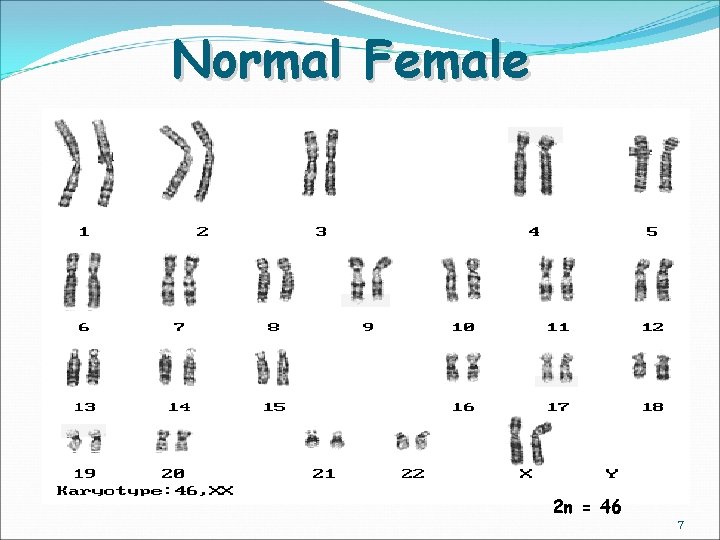 Normal Female 2 n = 46 7 