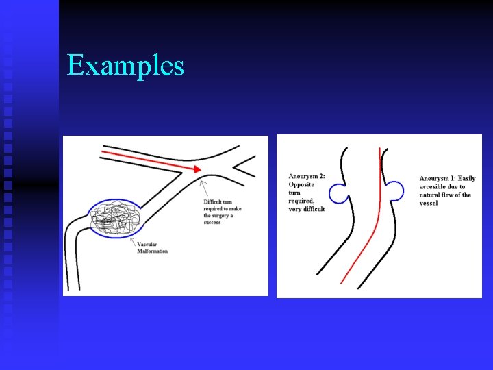 Examples 